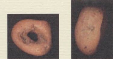 Doina Ioanid, Le collier de cailloux